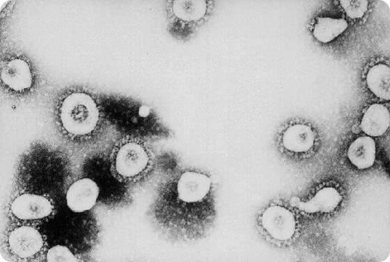 Transmission electron micrograph of coronavirus OC43: The coronavirus is now recognized as the etiologic agent of the 2003 SARS outbreak. Additional specimens are being tested to learn more about this coronavirus, and its etiologic link with Severe Acute Respiratory Syndrome. Credit: CDC/ Dr. Erskine Palmer Transmission electron micrograph of coronavirus OC43: The coronavirus is now recognized as the etiologic agent of the 2003 SARS outbreak. Additional specimens are being tested to learn more about this coronavirus, and its etiologic link with Severe Acute Respiratory Syndrome. Credit: CDC/ Dr. Erskine Palmer