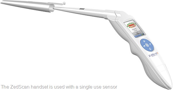 ZedScan-1-590
