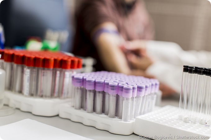 blood sampling for analysis