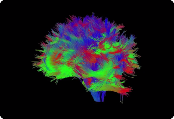 MRI Imaging