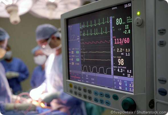 surgery monitoring