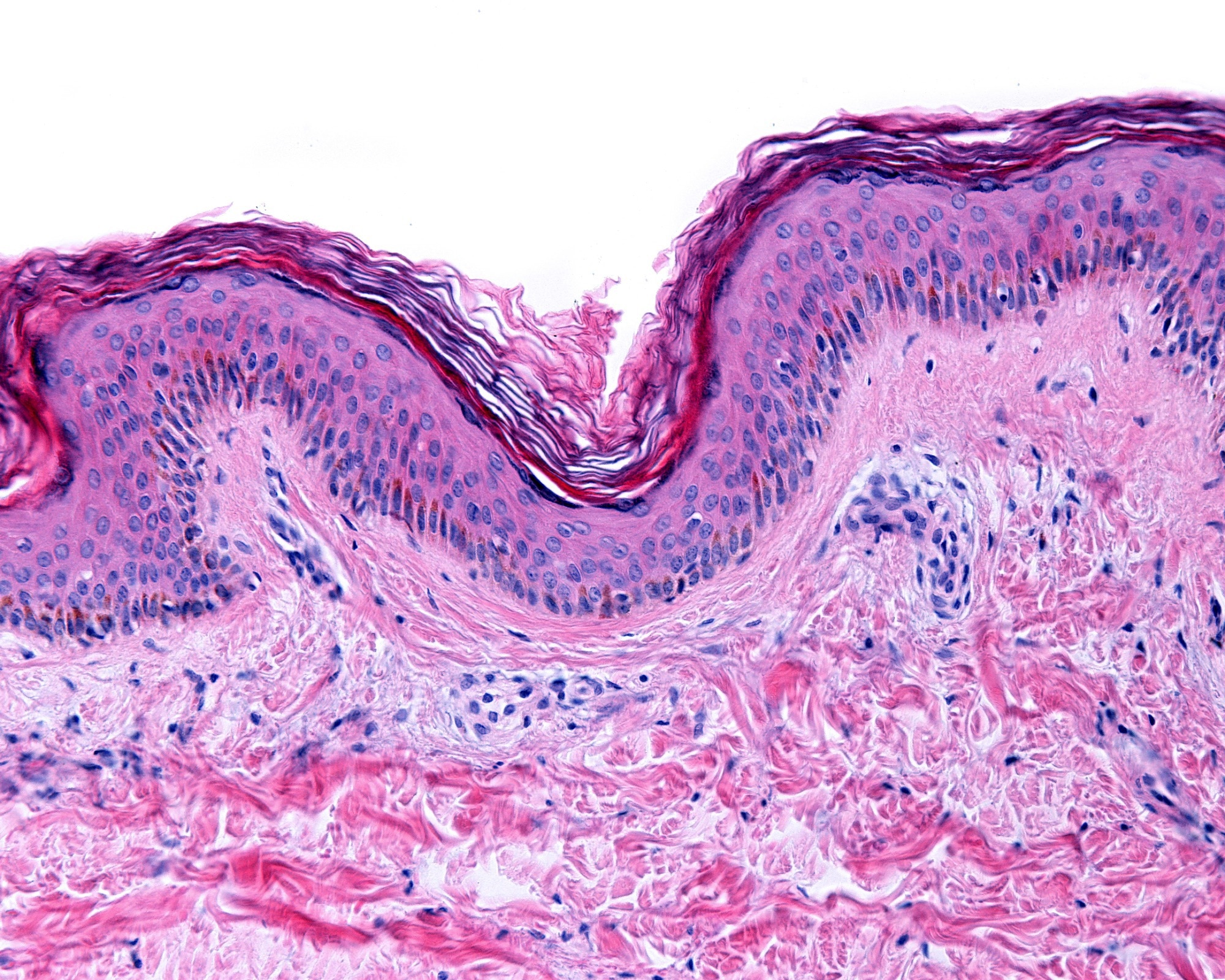 Thin skin showing the epidermis with its different strata, resting on the dermis. Image Credit: Jose Luis Calvo / Shutterstock.com