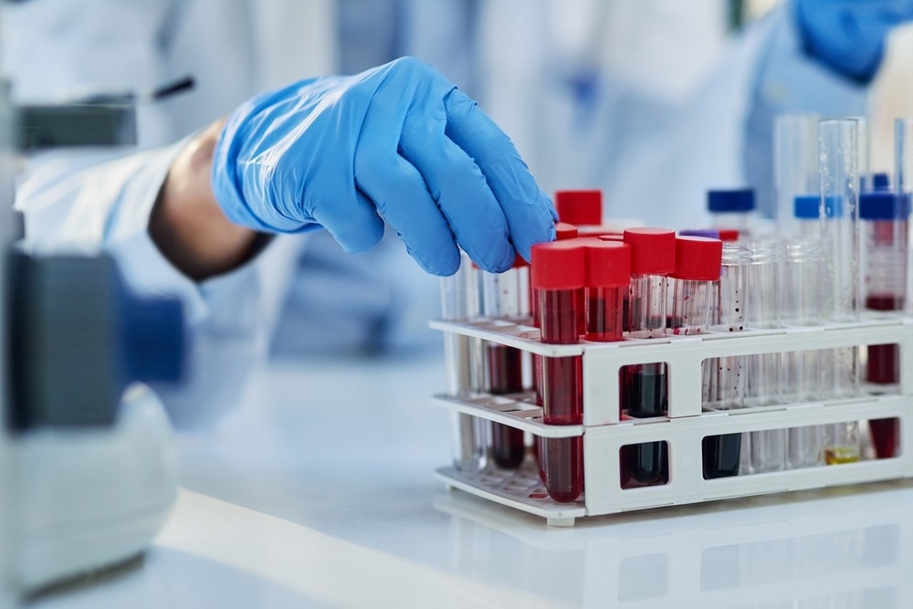 Close-up of a laboratory technician