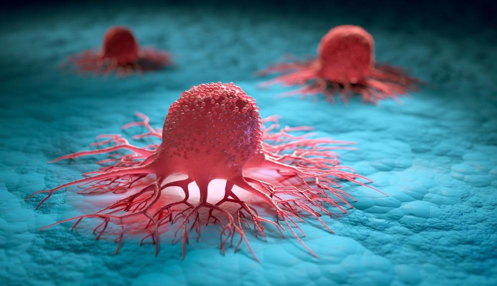Tumor Cells
