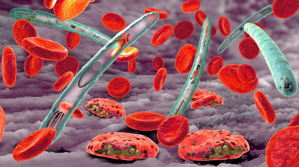Malaria