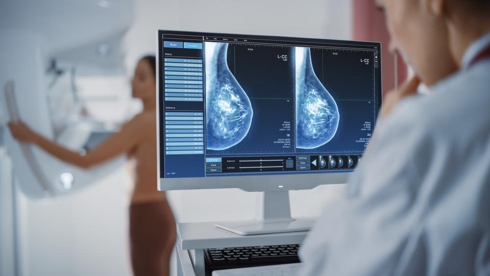 Breast cancer screening