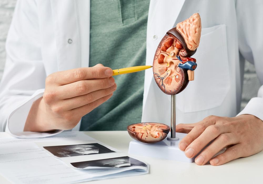 Kidney Disease Concept