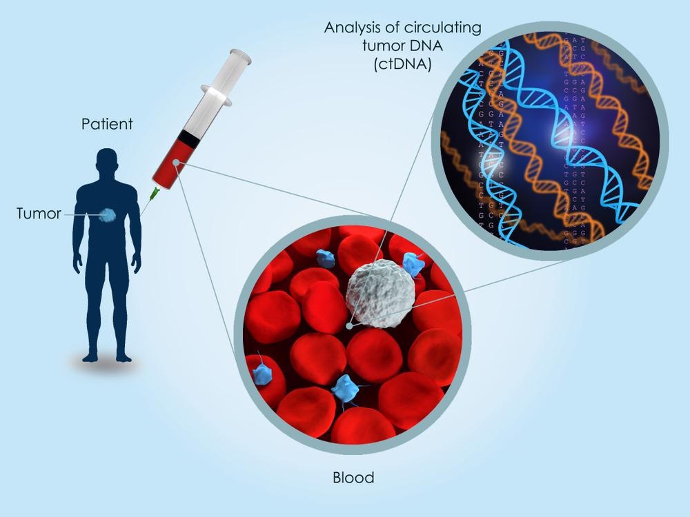 ctDNA