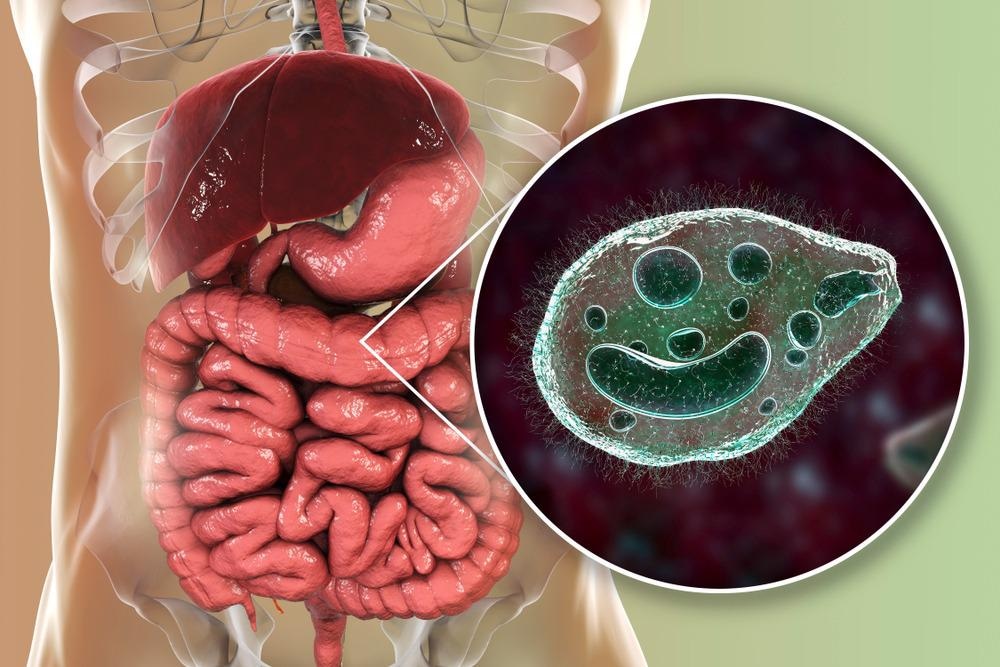 Balantidiasis