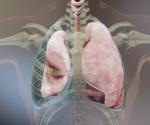 What Causes Empyema?