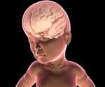 What is Bannayan-Riley-Ruvalcaba Syndrome?