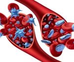 What is Thrombocytopenia?