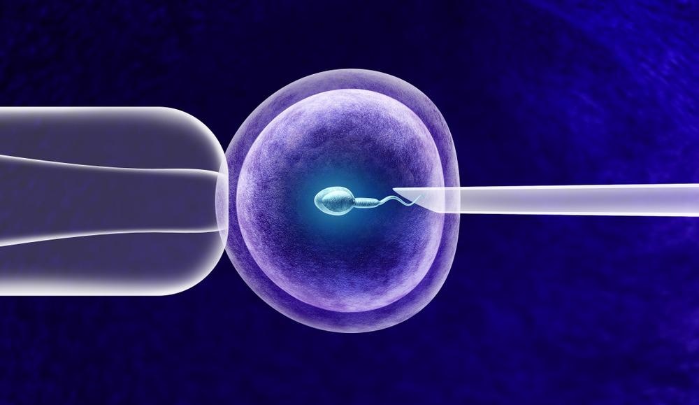 IVF