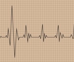 What is Ivemark Syndrome?