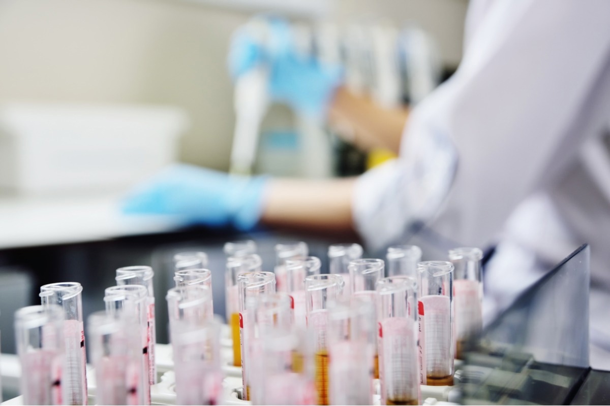 Genetic testing is often used to confirm a diagnosis of ODDD. Image Credit: Evgeniy Kalinovskiy/Shutterstock