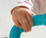 What is Oculodentodigital Dysplasia?