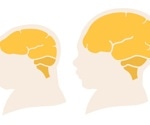What is Cerebro-Oculo-Facio-Skeletal Syndrome?