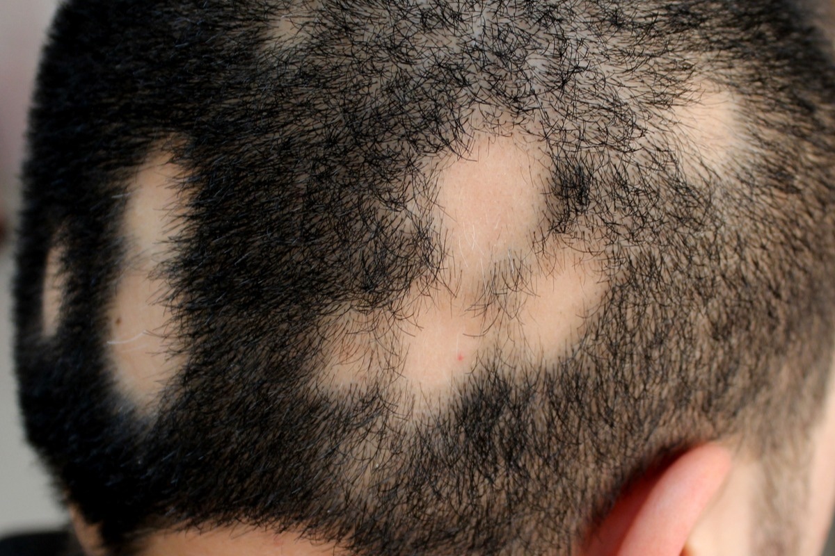 Image Credit: Dermatology11/Shutterstock