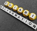 What are Chiari Malformations?