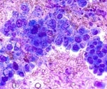 What are the Survival Rates for Lung Cancer?