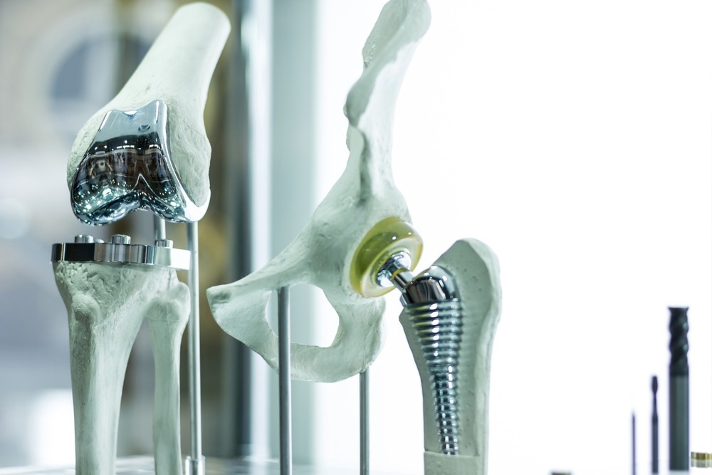 Hip implants can use bioceramics. Image Credit: Monstar Studio/Shutterstock.com Hip implants