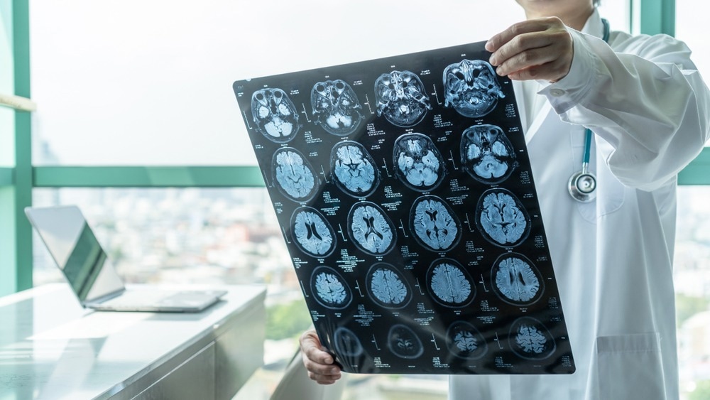 Brain aging
