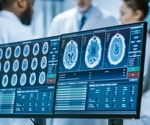 What is Rasmussen's Encephalitis (RE)?