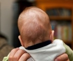 What is Craniosynostosis?