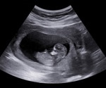The Biochemistry of a Fetus