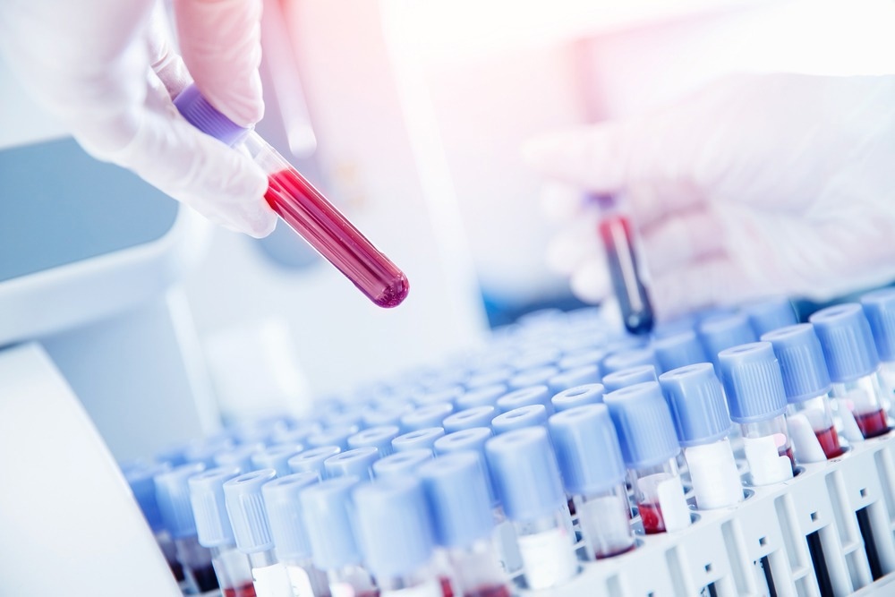 Blood Testing