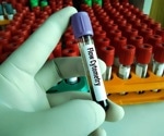 Applications of Flow Cytometry in Mycology