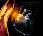 Preclinical Models of Myocardial Infarction