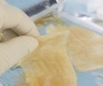 Hydrogels in Biomedicine