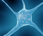 What is Myristoylation?
