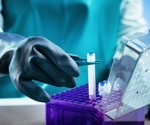 What Role do Biobanks Play in Cancer Research?