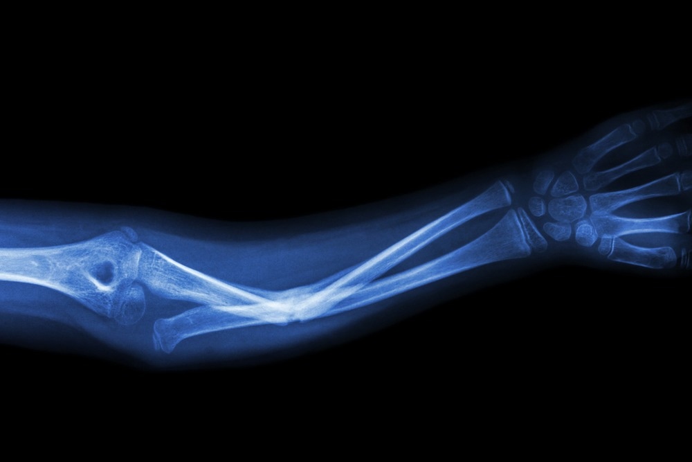 Image Credit: Puwadol Jaturawutthichai/Shutterstock.com