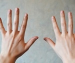 What are Drug-Induced Nail Disorders?