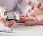 Epigenetic Mechanisms in Type 2 Diabetes