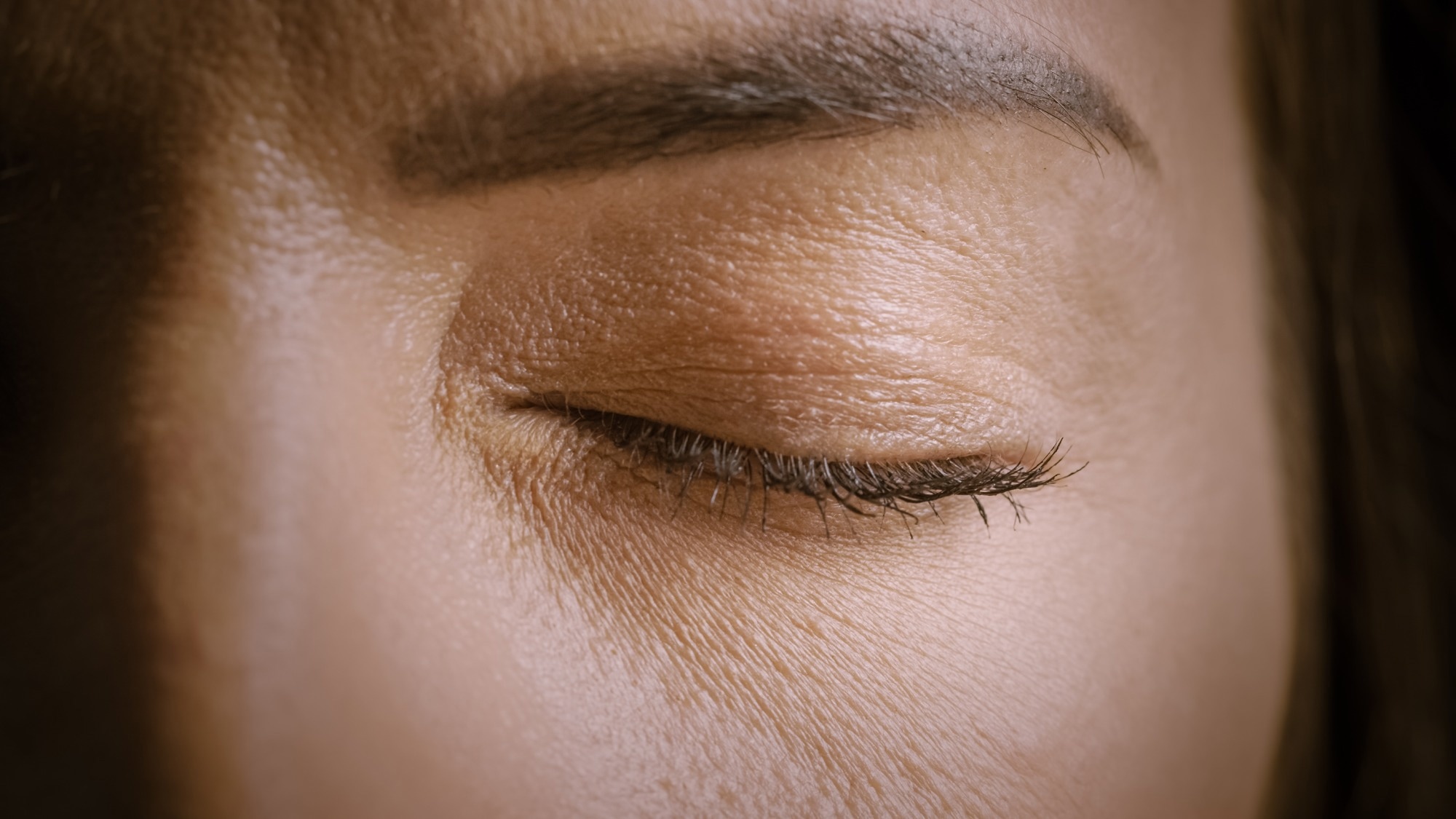 Benign essential blepharospasm