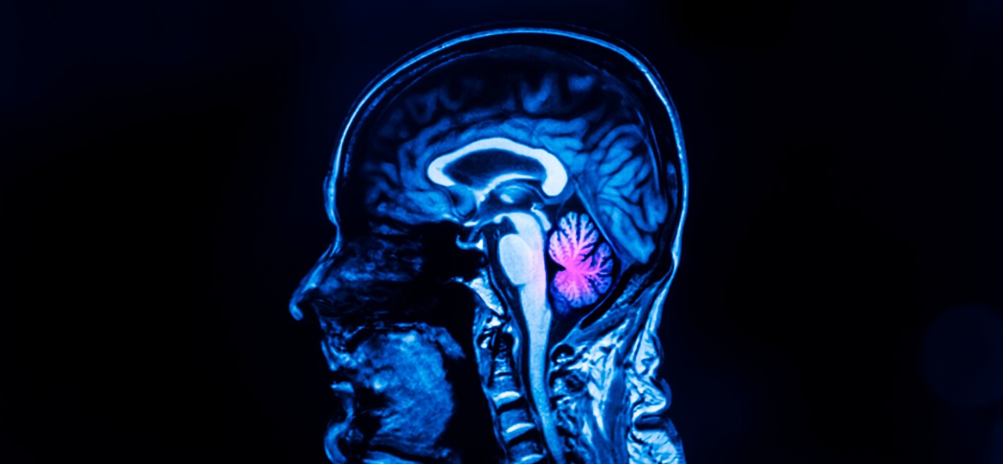 Cerebellum