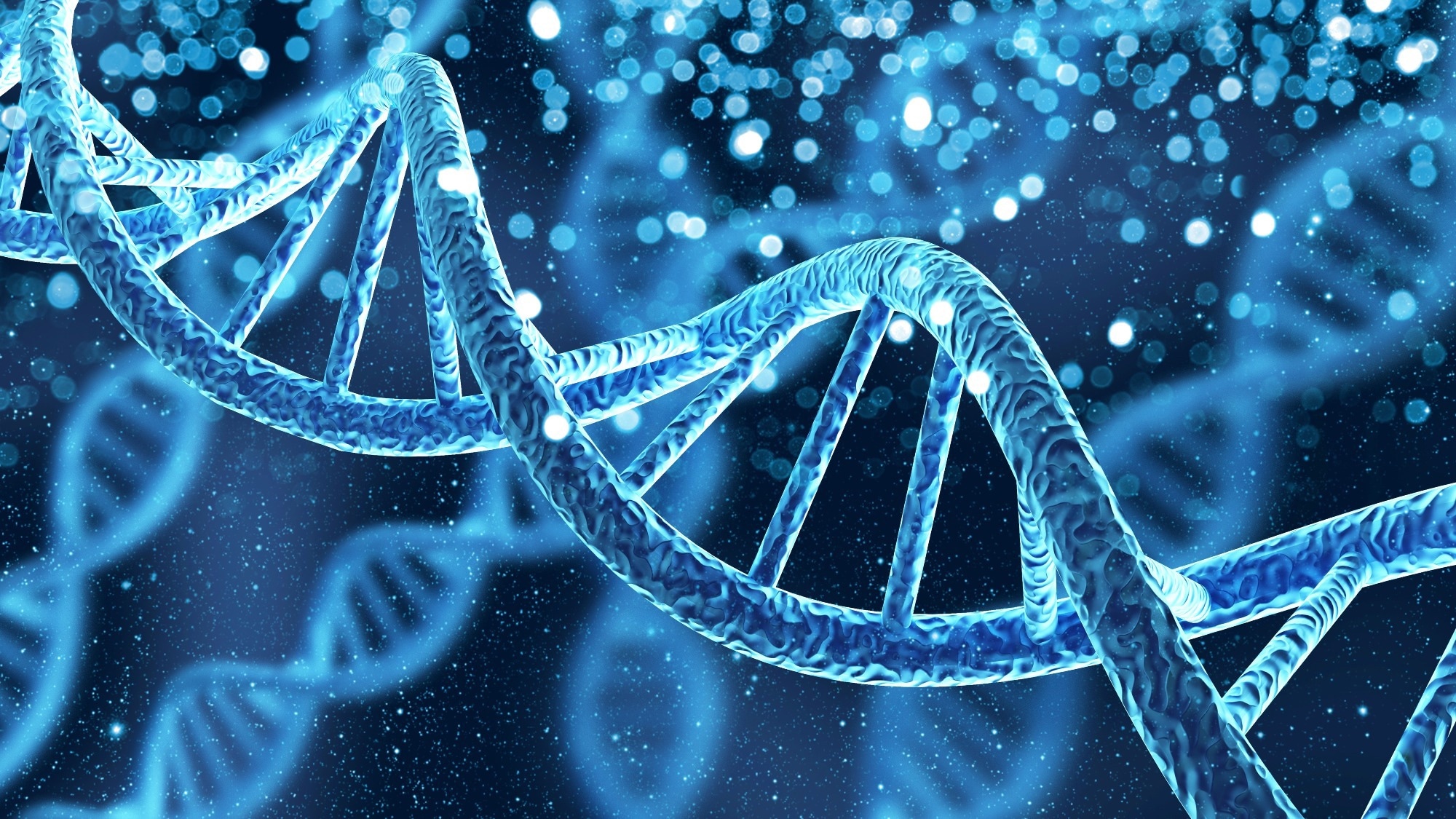 Borjeson-Forssman-Lehman syndrome or BFLS is an X-linked genetic disorder