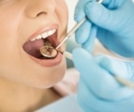 Why do I Gag at the Dentist?