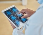 Spatial Transcriptomics in Neuroscience and Neurological Disorders
