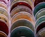 What is Agar?