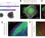 AAV capsid selection for transgene delivery in organoid models