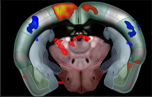 Functional ultrasound (fUS) imaging outline. fUS GLM map of brain response to pinprick.
