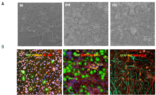 Characterization of the multi-cellular co-culture model. A) Brightfield live images (200x total magnification) at different culture time points post-co-culture. B) Representative images of multicellular co-cultures. Cells were stained for DAPI, MBP as myelin/oligodendrocyte marker, beta-III tubulin or NF-200 to stain neuronal axons, GFAP as astrocyte marker and Iba1 microglia marker