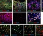 Validation of a cortical tri-culture axoModel™ for in vitro compound screening: A blinded compound study