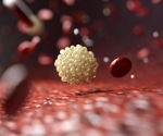 What is Very Long Chain Acyl CoA Dehydrogenase Deficiency (VLCAD)?
