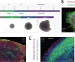 iPSC-derived organoids for organ-specific disease modeling